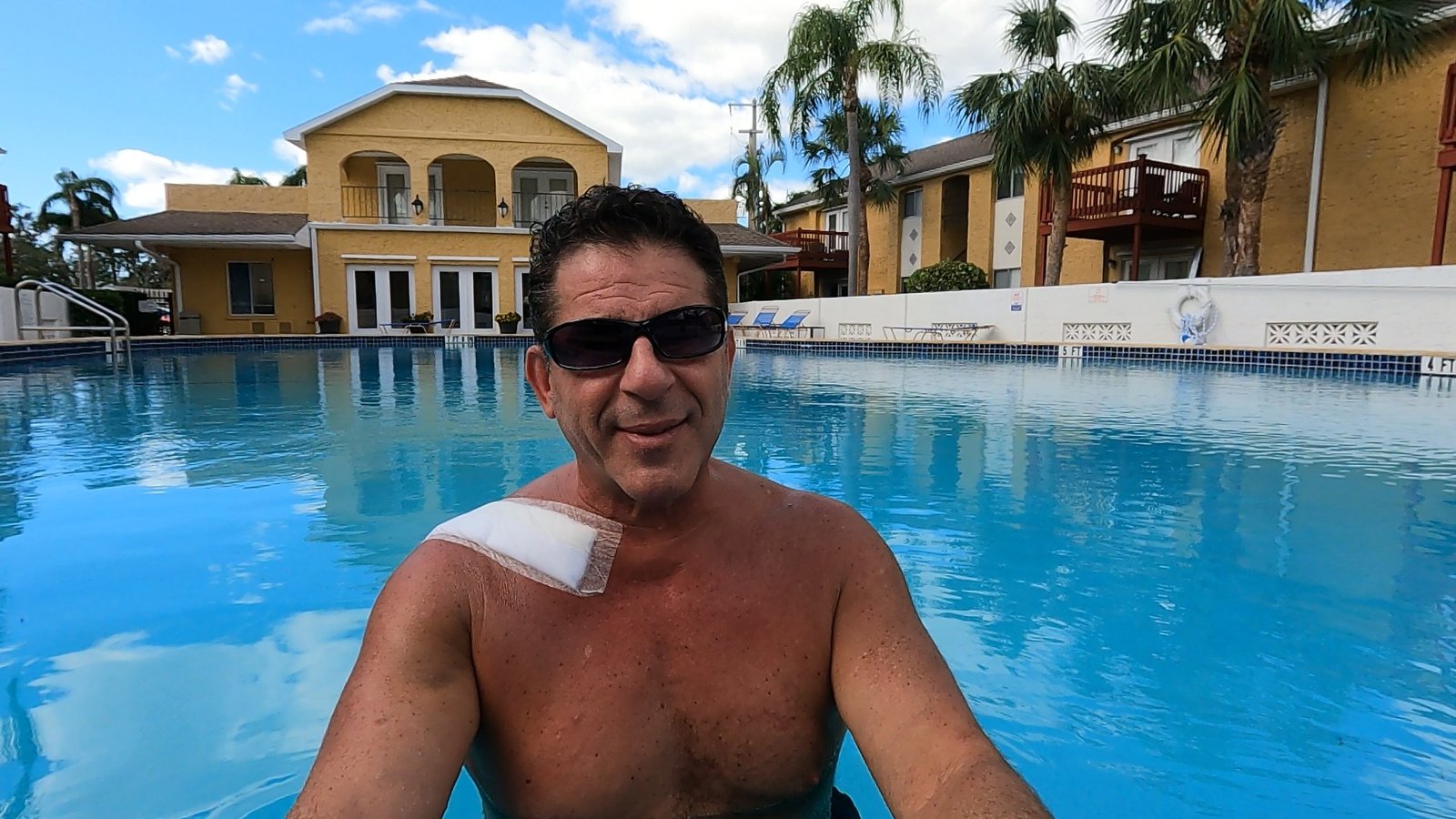 Stuart Davidson using water during his own recovery after clavicle repair surgery